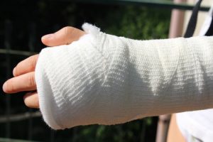 hand injury