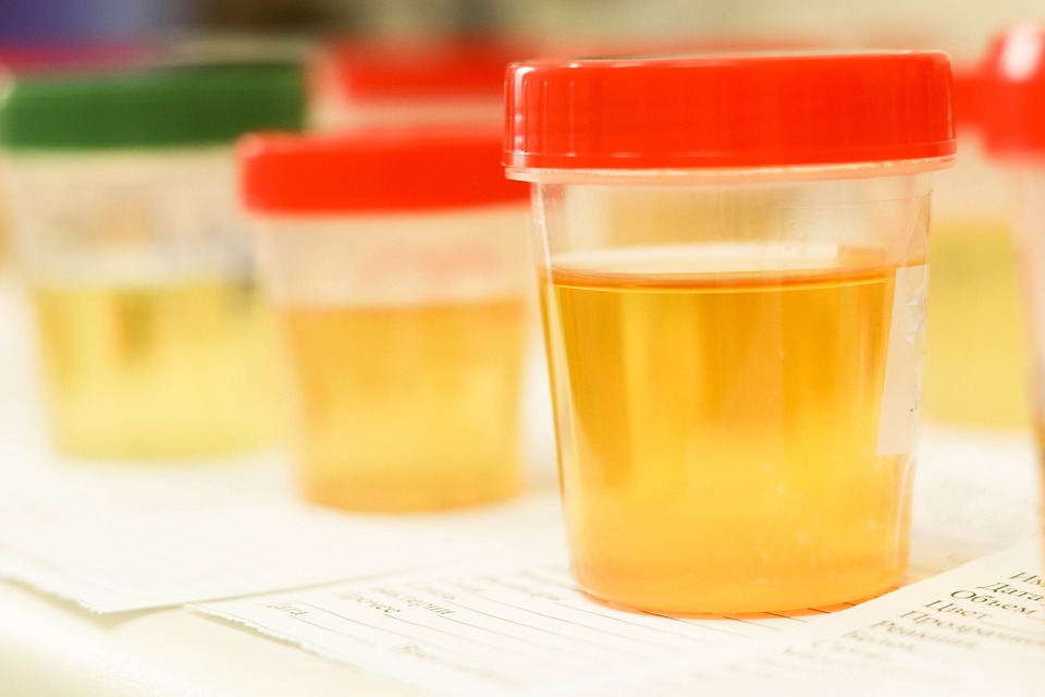 lab urine sample